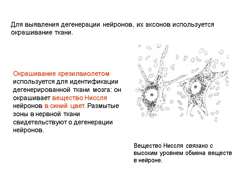 Для выявления дегенерации нейронов, их аксонов используется окрашивание ткани. Вещество Ниссля связано с высоким